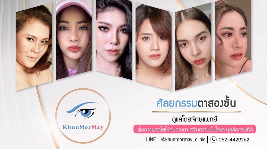 KhunmorMay Clinic รับแก้กล้ามเนื้อตาอ่อนแรง หลักเทคนิครักษาเลือกวิธีการทันสมัยมาให้ตัดสินใจท