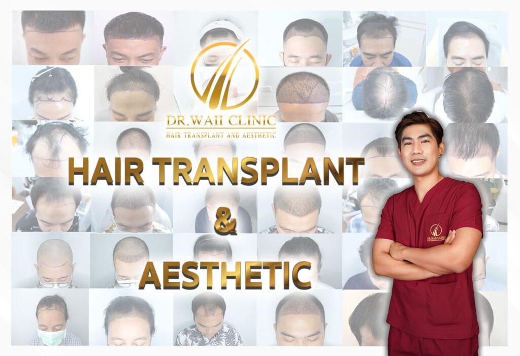 Dr.Waii Clinic บริการปลูกผม นครสวรรค์ กระตุ้นความแข็งแรงของเส้นผมลงลึกไปจนถึงราก