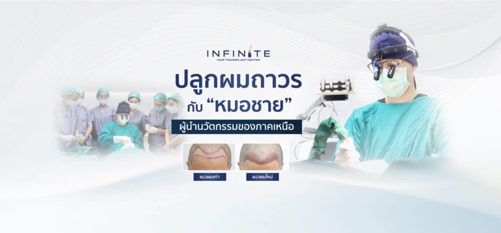 Infinite Hair Clinic บริการปลูกผม เชียงใหม่ ผลลัพธ์เส้นผมหลังการปลูกแข็งแรง ผมหนายาวดำสวยไม่เหมื