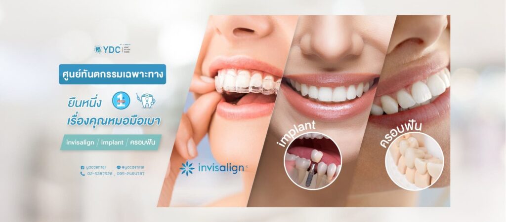 YDC Dental Clinic คลินิกรากฟันเทียม เสริมความมั่นใจให้ทุกรอยยิ้มกลับมาสวยเด่นชัด